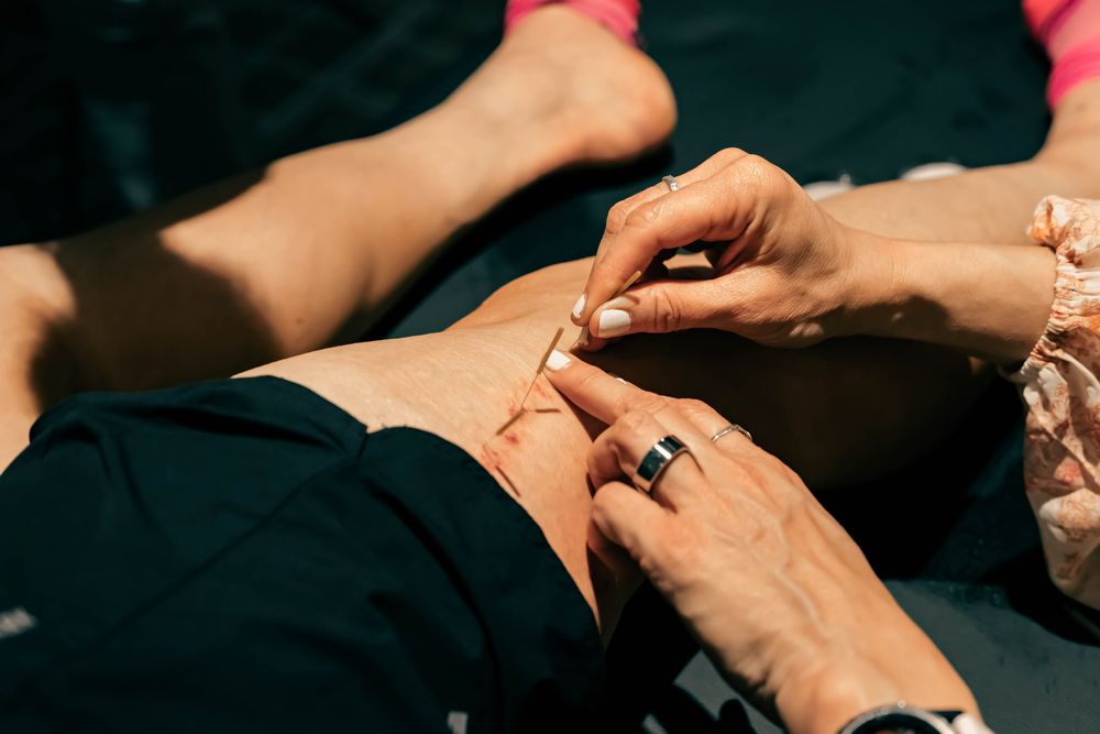 Acupuncture recovery treatment in the field